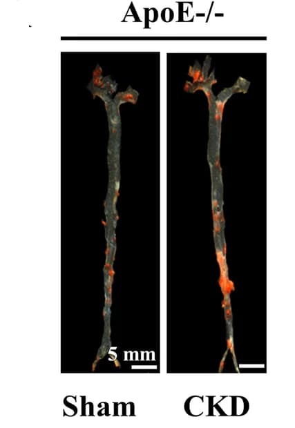 Open access visualization of Photo, Oil Red O Staining, Aorta, Atherosclerotic Lesions, CKD-ApoE -/- Mice
