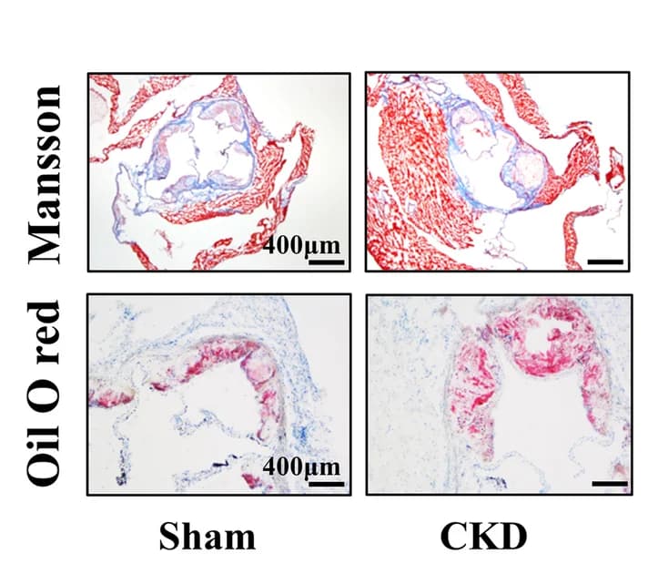 Open access visualization of Microscopy, Oil Red O Staining, Masson-Trichrome Staining, Collagen, Aortic Sinus