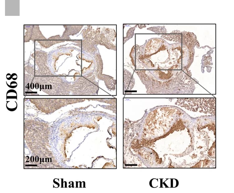 Open access visualization of Microscopy, Immunohistochemical Staining, CD68, Macrophages, Aortic Sinus