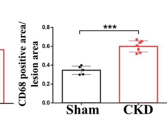 Open access visualization of Bar Plot, Error Bars, Immunohistochemical Staining, CD68, Macrophages