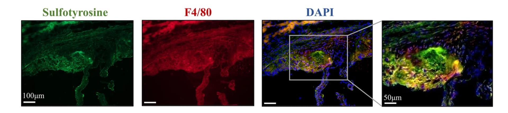 Open access visualization of Microscopy, Immunostaining, Sulfotyrosine, F4/80, Aortic Root
