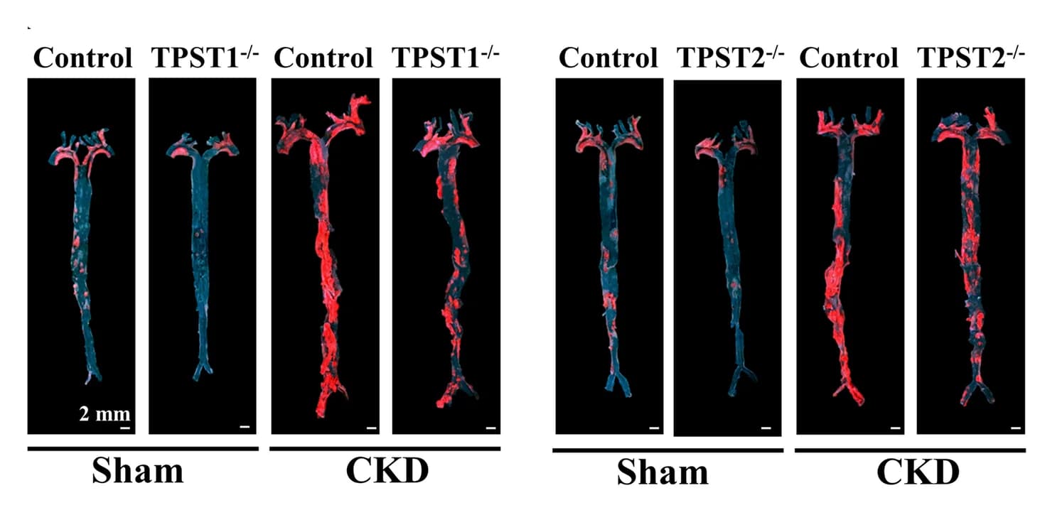 Open access visualization of Microscopy, Photo, Oil Red O staining, Aortas, ApoE -/- mice