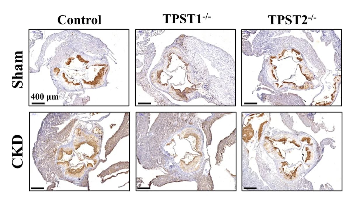Open access visualization of Microscopy, CD68+ macrophages, Aortic vascular plaques, TPST1 knockout, ApoE -/- mice
