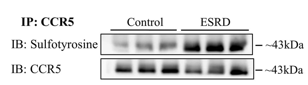 Open access visualization of Gel, Western Blot, CCR5, PBMCs, ESRD Patients