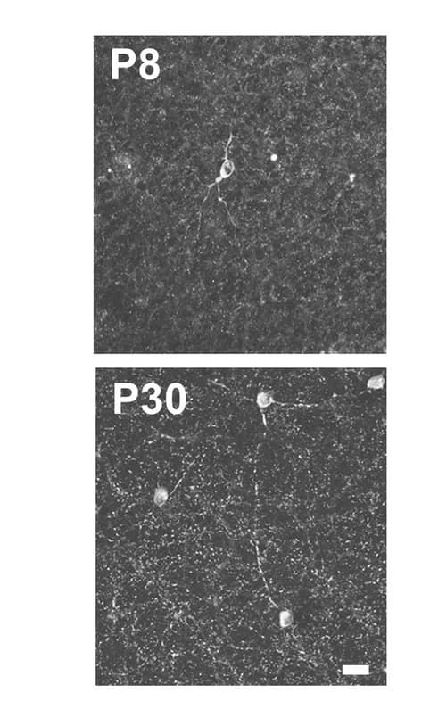 Open access visualization of Microscopy, Retina, Tyrosine Hydroxylase, Immunopositive Cells, Retinal Explants