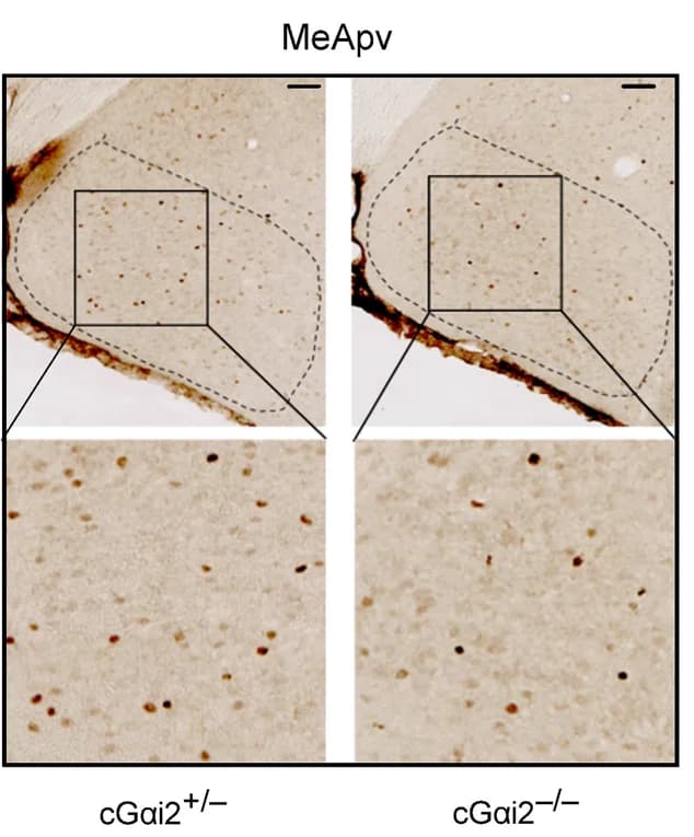 Open access visualization of Microscopy, c-Fos activation, MeApv, VMHdm, LHb