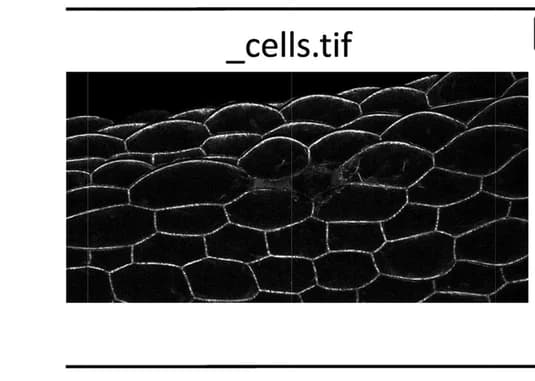 Open access visualization of Microscopy, Epidermal Cell Contours, Z-stack, 2D Projection, SurfCut