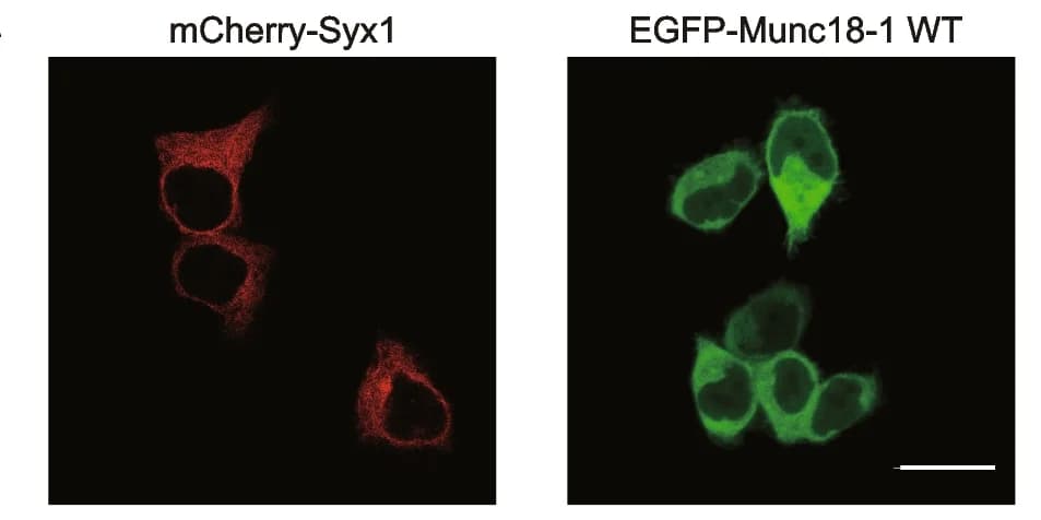 Open access visualization of Microscopy, HEK293T Cells, EGFP-Munc18-1, mCherry2-Syx1, Transfection