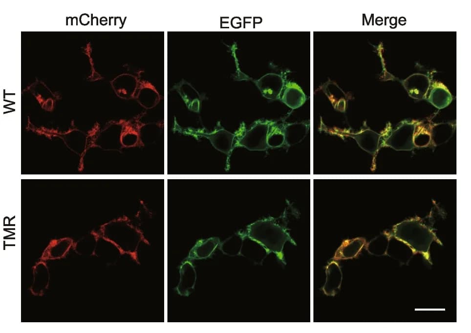 Open access visualization of Microscopy, HEK293T Cells, mCherry2-Syx1, EGFP-Munc18-1, WT