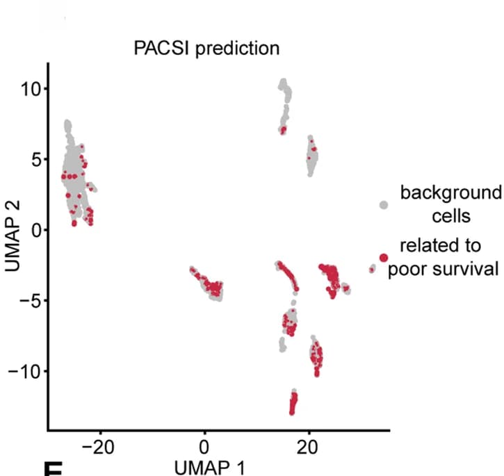 Open access visualization of Scatter Plot, UMAP, PACSI, Tumor Cells, BRCA