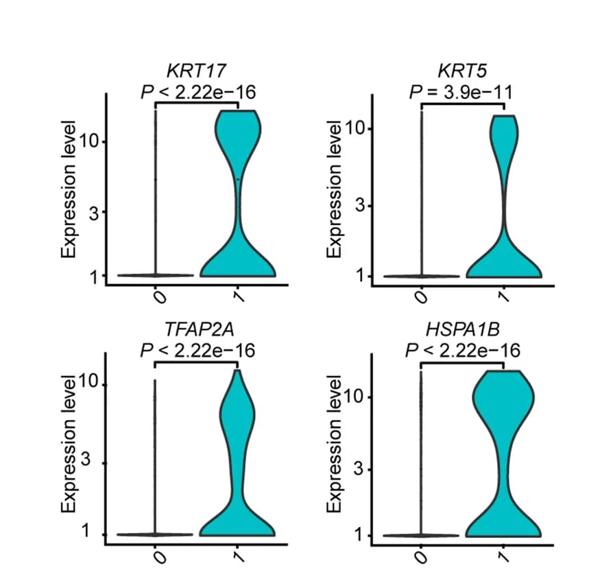 Open access visualization of Violin Plot, Violin Plots, Gene Expression, PACSI, Tumor Cells