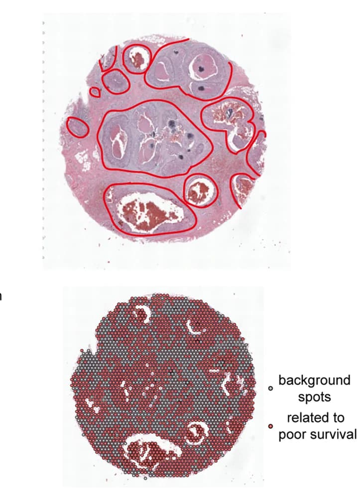 Open access visualization of Microscopy, Scatter Plot, Histopathological Annotations, Breast Cancer, Malignant Cells