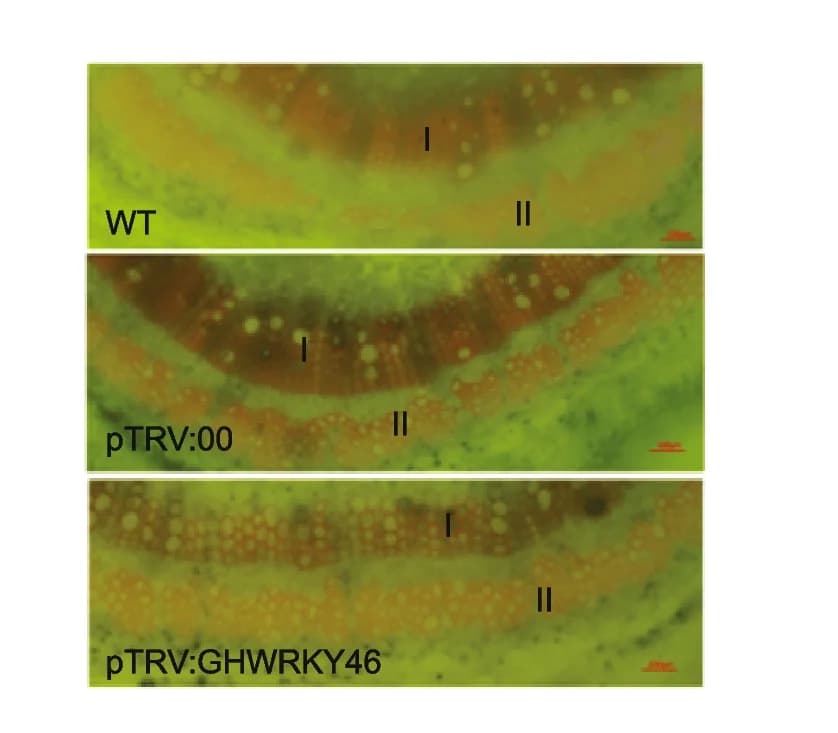 Open access visualization of Microscopy, Lignin, Histochemical Staining, Cotton Stalks, Primary Xylem
