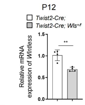 Open access visualization of Bar Plot, Error Bars, Quantitative PCR, Intestinal Stromal Cells, Pups