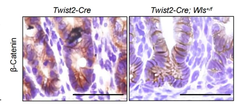Open access visualization of Microscopy, Immunohistochemical Staining, β-Catenin, Intestinal Villi, Pups