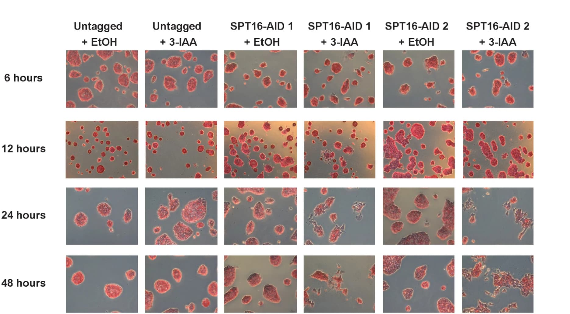 Open access visualization of Microscopy, Timecourse, IAA Treatment, SPT16 Depletion, Morphological Changes