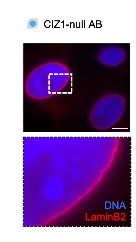 Open access visualization of Microscopy, Nuclear Lamina, Immunodetection, Lamin B2
