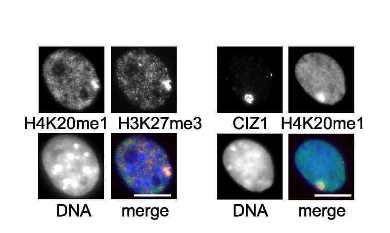 Open access visualization of Microscopy, H4K20me1, H3K27me3, CIZ1, Xi
