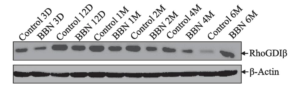 Open access visualization of Gel, UROtsa Cells, BBN Exposure, Western Blot, RhoGDI Expression