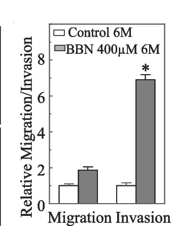 Open access visualization of Bar Plot, Error Bars, Clustered, UROtsa Cells, Cell Invasion