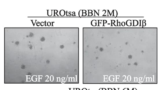 Open access visualization of Microscopy, Cell Growth, UROtsa Cells, Soft Agar, EGF