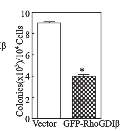 Open access visualization of Bar Plot, Error Bars, Cell Growth, UROtsa Cells, Soft Agar