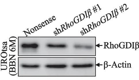 Open access visualization of Gel, RhoGDI, Knockdown, UROtsa Cells, Transfection
