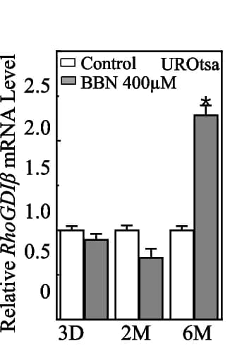 Open access visualization of Clustered, Error Bars, UROtsa Cells, BBN Treatment, RhoGDIβ mRNA