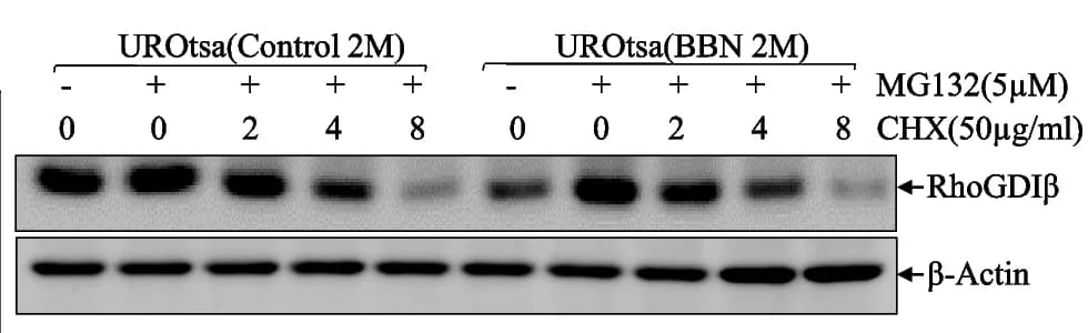 Open access visualization of Gel, UROtsa Cells, MG132, RhoGDIβ Protein, Protein Degradation