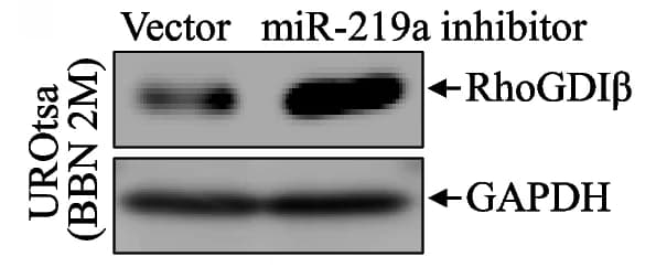 Open access visualization of Gel, RhoGDI, Protein Expression, Western Blot, GAPDH