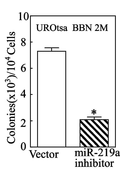 Open access visualization of Bar Plot, Error Bars, Colony Formation, UROtsa Cells, Soft-Agar Assay