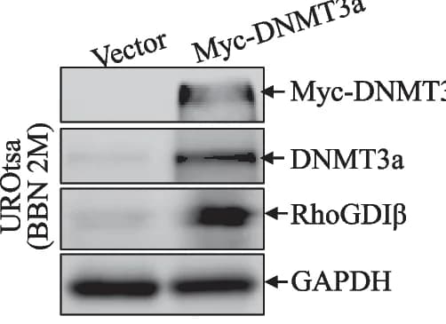 Open access visualization of Gel, DNMT3a, DNMT3b, Myc-tag constructs, UROtsa BBN2mo cells