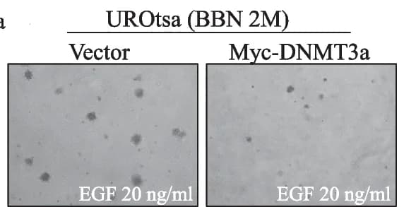 Open access visualization of Microscopy, UROtsa BBN2mo /Vector cells, UROtsa BBN2mo /Myc-DNMT3a cells, Soft agar, EGF