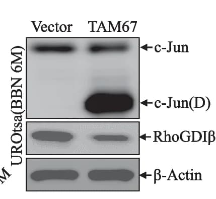Open access visualization of Gel, TAM67, UROtsa BBN6mo cells, c-JUN, RhoGDI