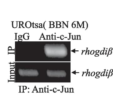 Open access visualization of Gel, ChIP assay, c-Jun, Antibody, RhoGDI promoter
