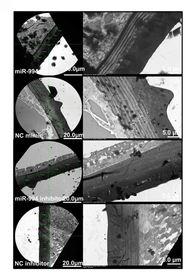 Open access visualization of Microscopy, Ultrastructure, Pronotum, Cuticle, Synthetic miR-994
