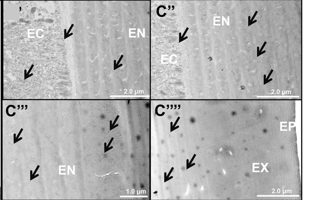 Open access visualization of Microscopy, Immunolocalization, Cuticle, Epicuticle, Exocuticle