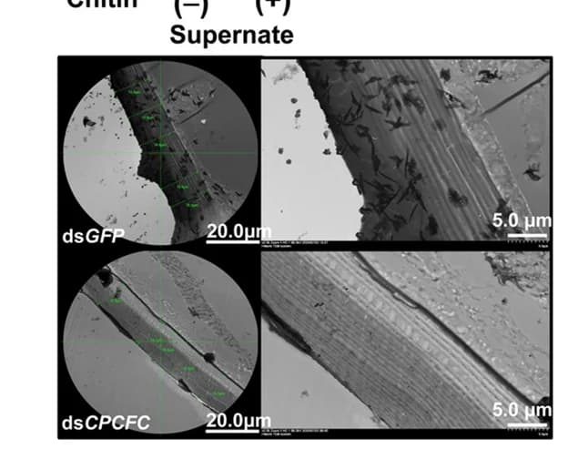 Open access visualization of Microscopy, Cuticular Ultrastructure, Gene Silencing