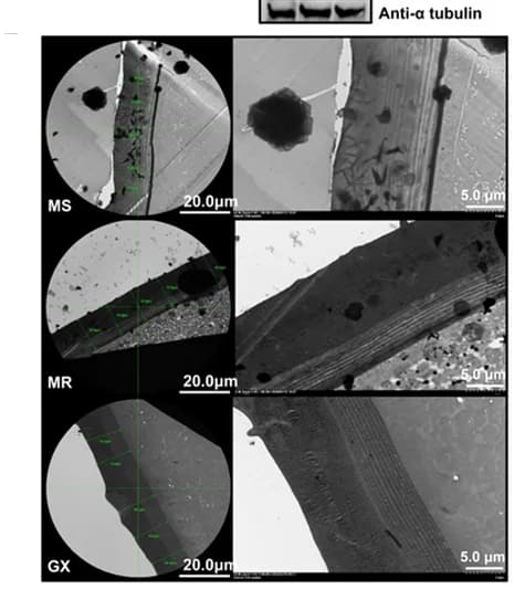 Open access visualization of Microscopy, Gel, Cuticular Ultrastructure, MS Strain, MR Strain