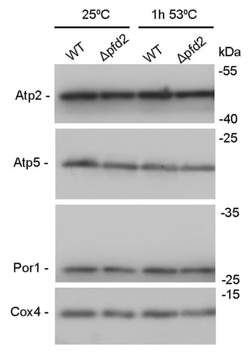 Open access visualization of Gel, Mitochondria, SDS-PAGE, Western Blot, Yeast Cells