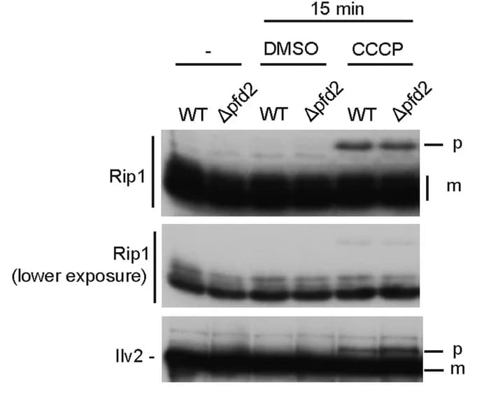 Open access visualization of Gel, Yeast Cells, CCCP, DMSO, Western Blot