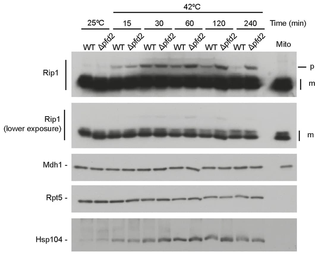 Open access visualization of Gel, Yeast Cells, Galactose, SDS-PAGE, Western Blot