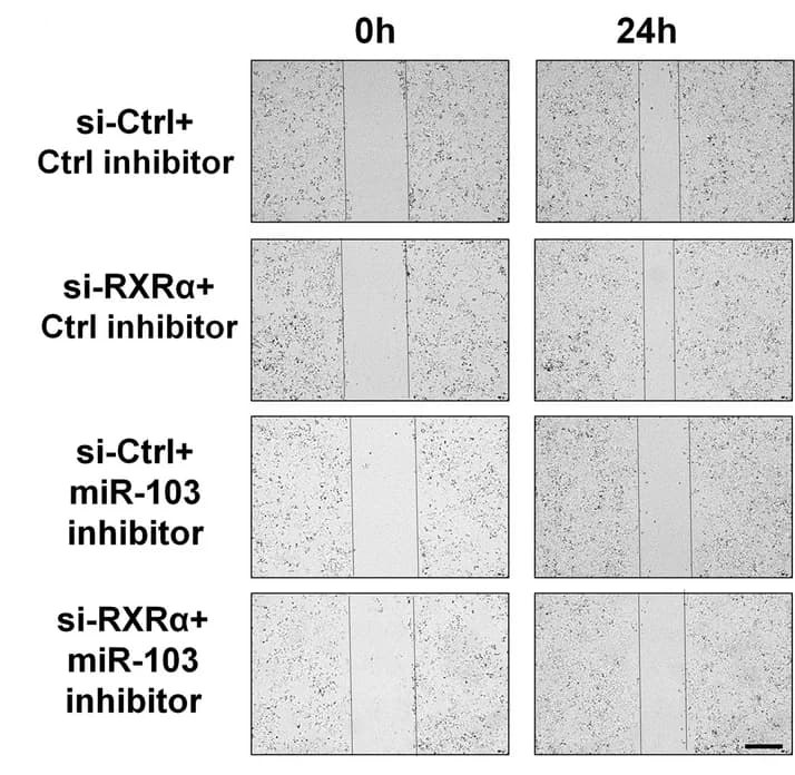 Open access visualization of Microscopy, Wound Healing Assay, MDA-MB-231 Cells, Transfection, RXRa siRNA