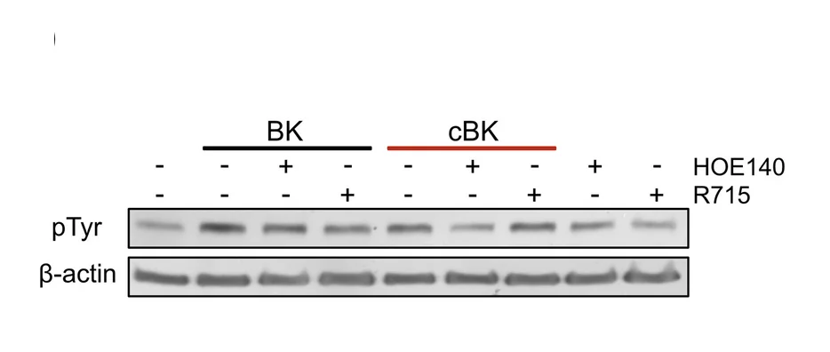 Open access visualization of Gel, pTyr Residues, HaCaT Lysates, BK, cBK