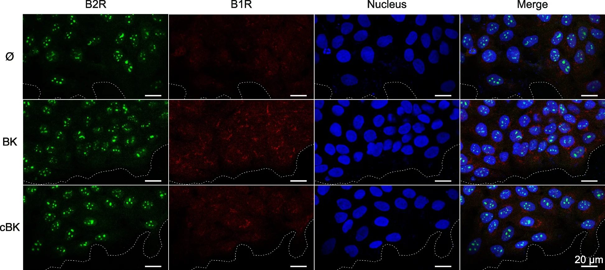 Open access visualization of Microscopy, B2 Receptor, B1 Receptor, Wound Healing, HaCaT Cells