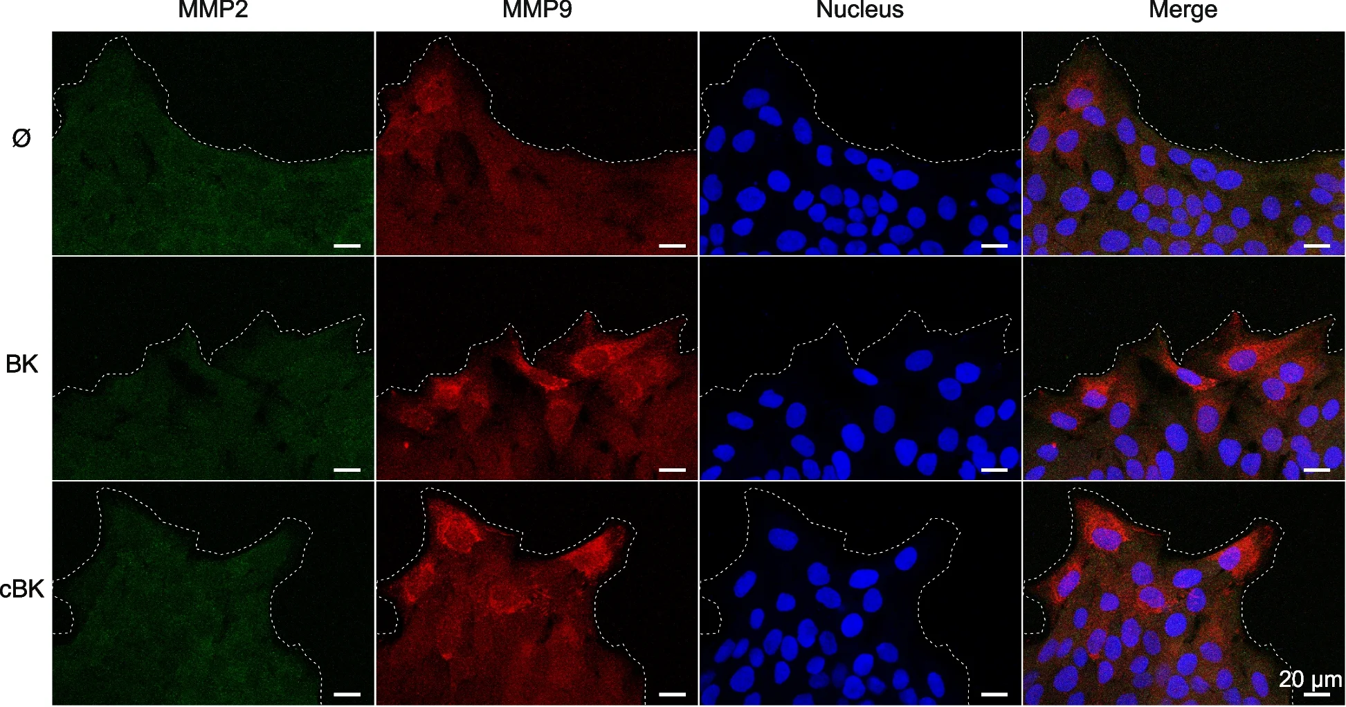 Open access visualization of Microscopy, MMP2, MMP9, Wound Healing, HaCaT Cells