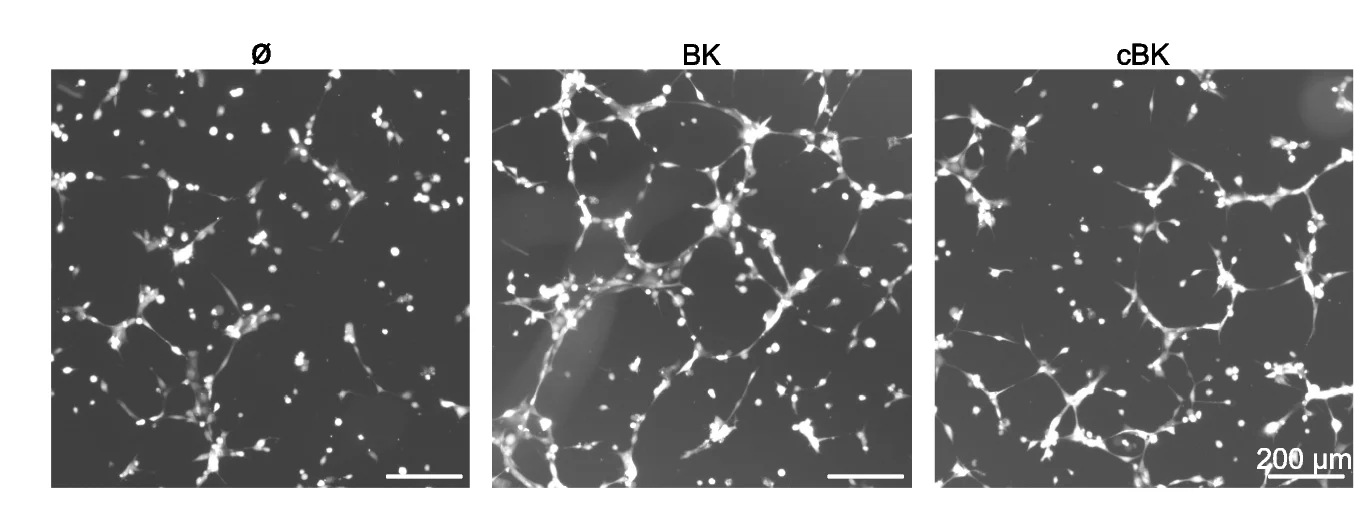 Open access visualization of Microscopy, CFSE Staining, HBEC-5i Cells, FBS, BK