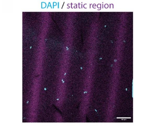 Open access visualization of Microscopy, Nucleus Positioning, Human Dermal Fibroblasts, Dynamic Gel, Topographical Changes