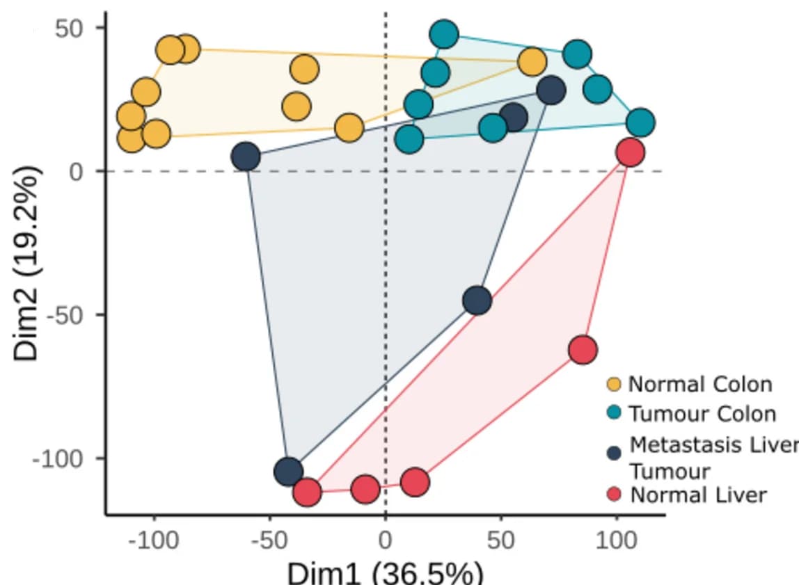 Open access visualization of Scatter Plot, PCA, Principal Component Analysis, Normal Colon Tissue, Primary Tumor