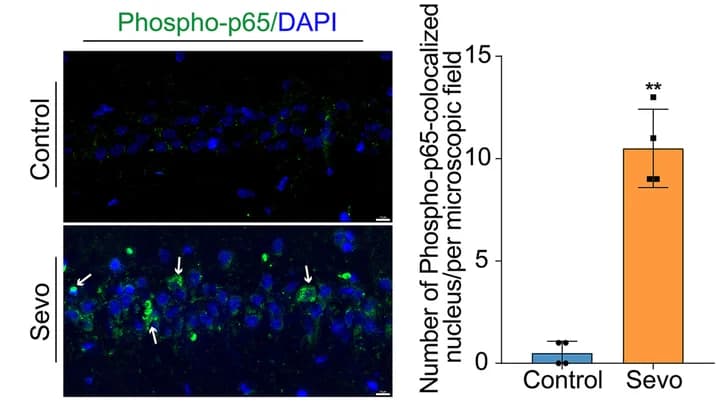 Open access visualization of Bar Plot, Error Bars, Microscopy, Phospho-NF-κB P65, Nuclei